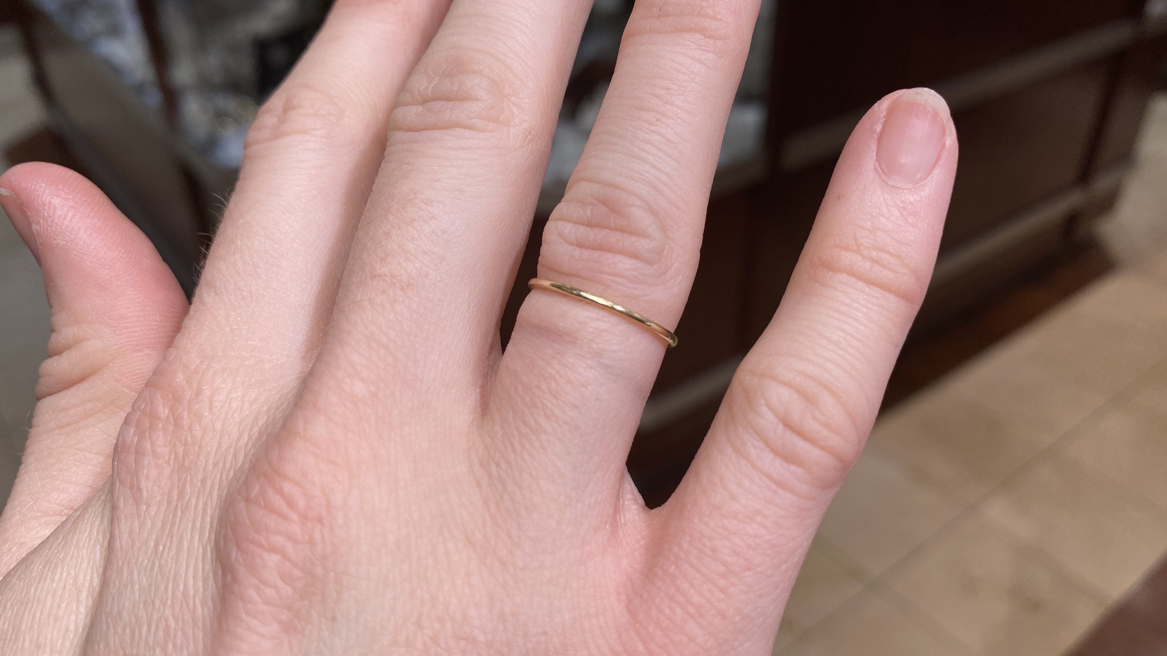 Why is my gold jewelry turning my skin black or green? - PBD